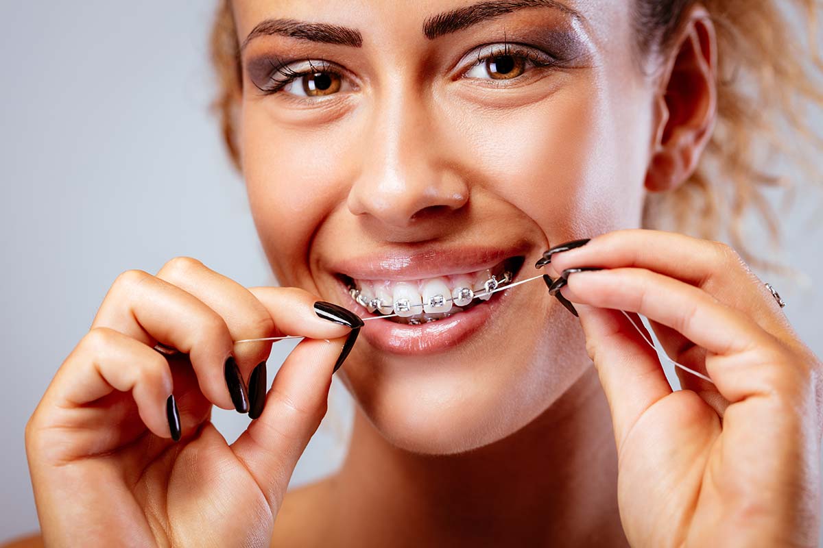 Why Flossing is Essential While Wearing Braces  Guest Post